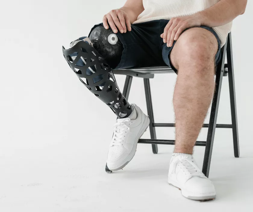 Above Knee Amputation