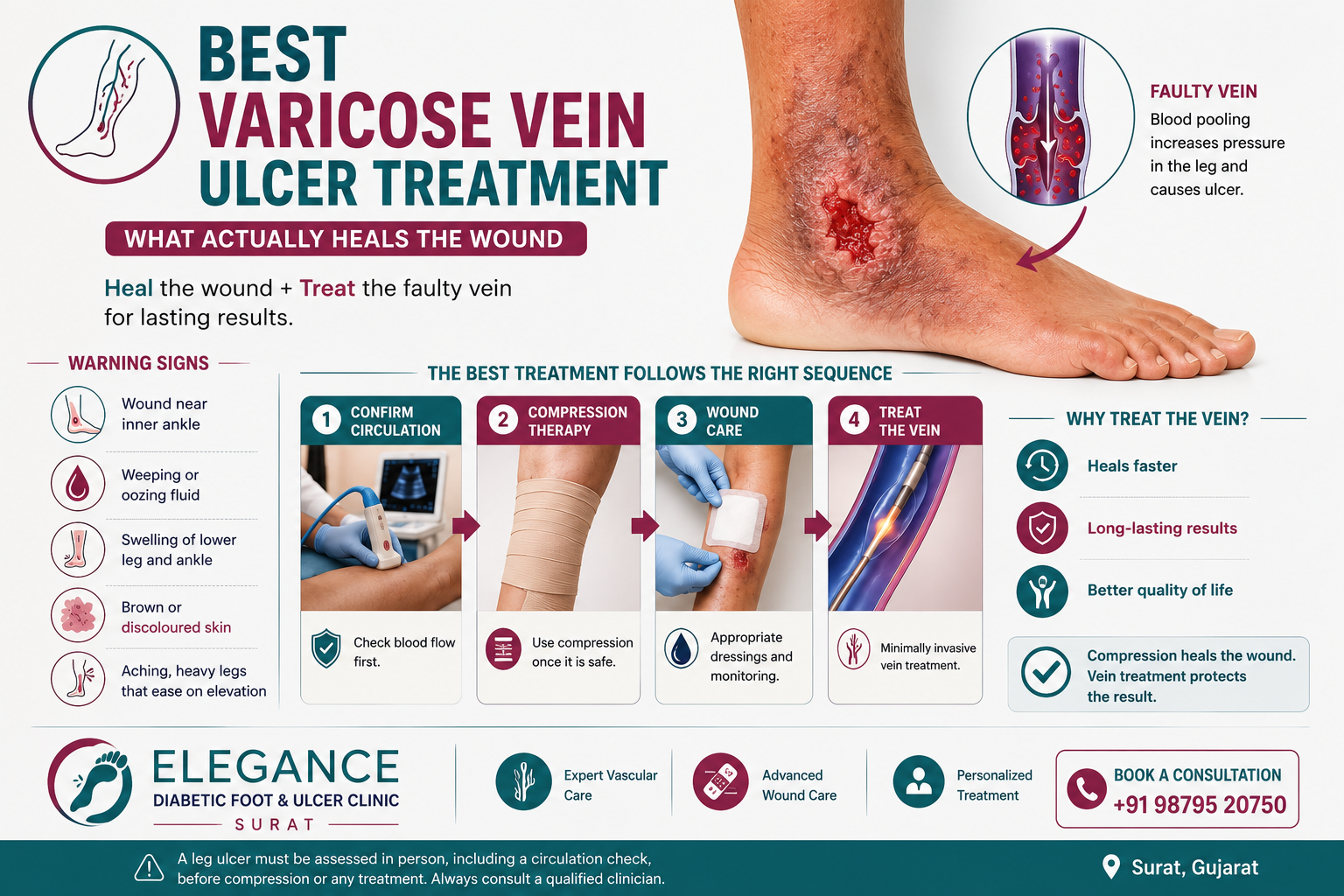 Best Varicose Vein Ulcer Treatment: What Actually Heals the Wound