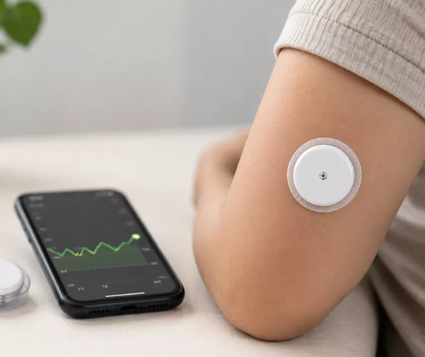 Continuous Glucose Monitoring (CGM)