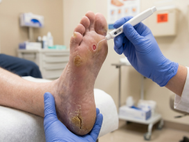 Diabetic Foot Assessment & Diagnostics