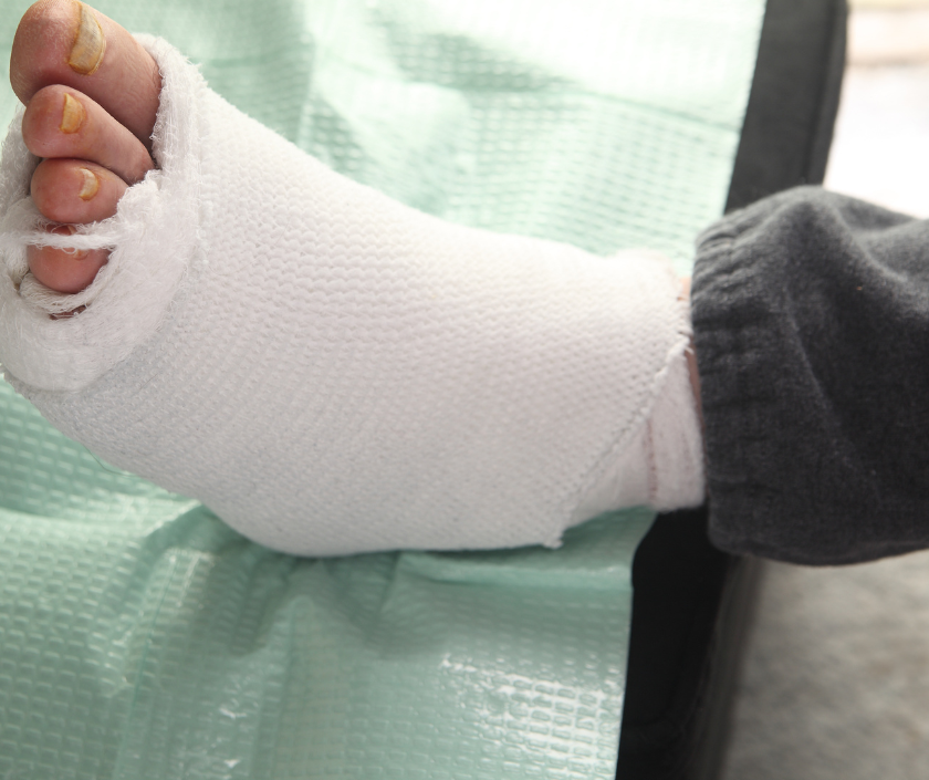 Diabetic Foot Risk Assessment at Elegance Diabetic Foot & Ulcer Clinic (EDFC), India