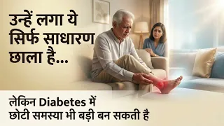 Collagen Dressing Benefits: How It Heals Non-Healing and Diabetic Foot Wounds