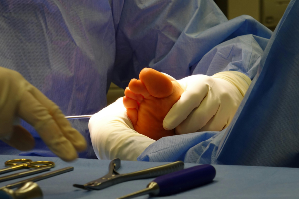 Endovascular Procedures at Elegance Diabetic Foot & Ulcer Clinic (EDFC), India