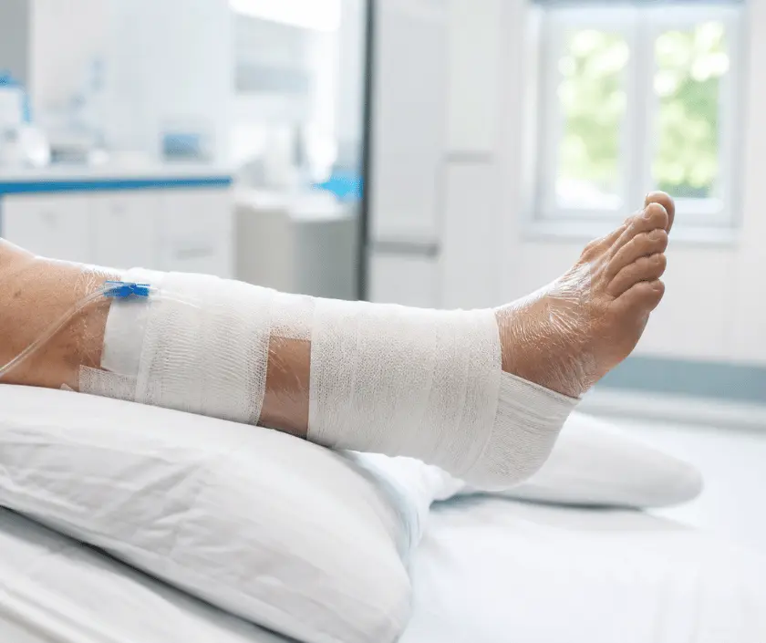 fasciotomy