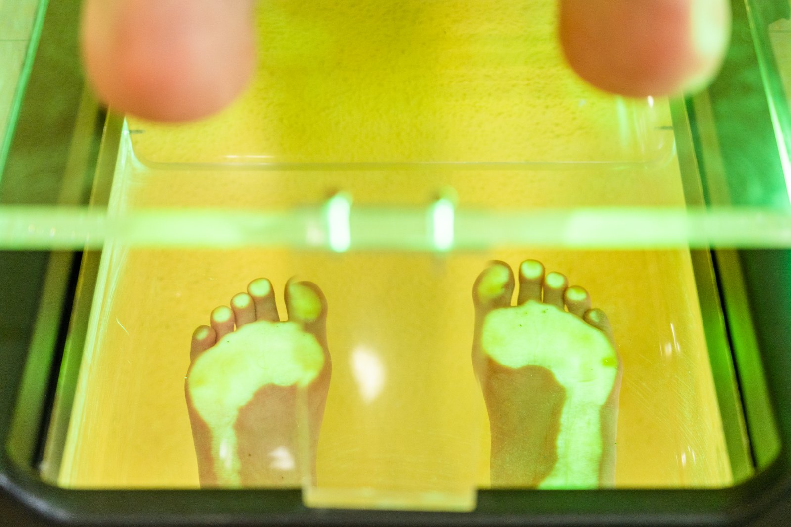 Morning Heel Pain? Find the Real Cause, Not Just a Painkiller