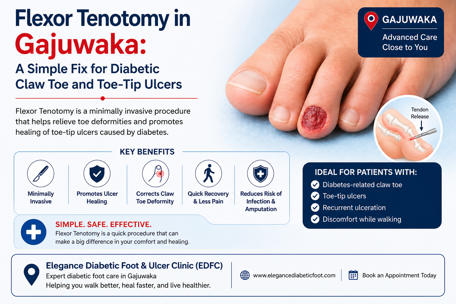 Flexor Tenotomy in Gajuwaka: A Simple Fix for Diabetic Claw Toe and Toe-Tip Ulcers
