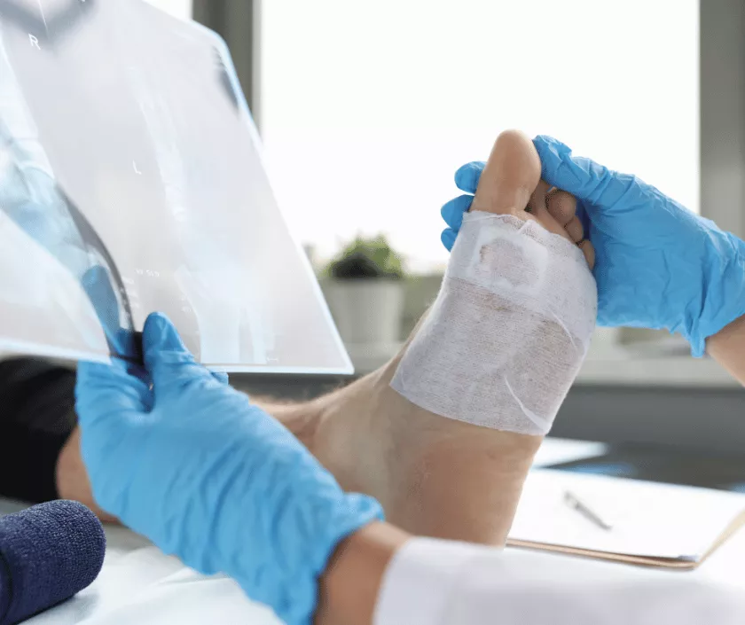 Foot Realignment Surgery