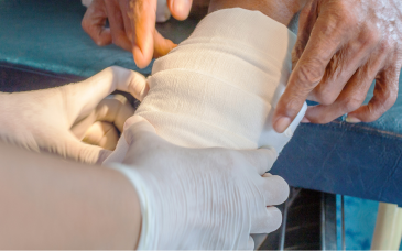 Gangrene Management at Elegance Diabetic Foot & Ulcer Clinic (EDFC), India