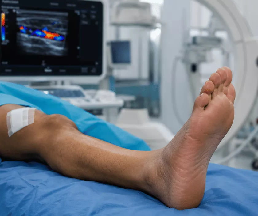 Limb Salvage Revascularization