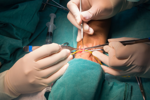 Limb Salvage Surgery at Elegance Diabetic Foot & Ulcer Clinic (EDFC), India