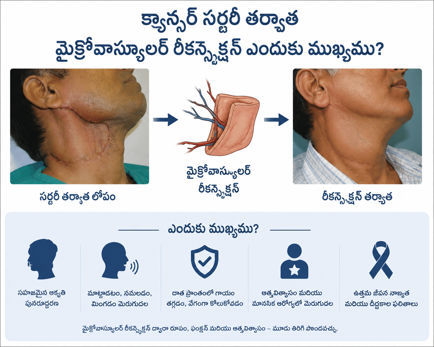 microvascular reconstruction