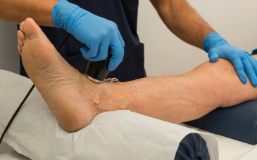 MLS Laser Therapy at Elegance Diabetic Foot & Ulcer Clinic (EDFC), India