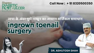 Ingrown Toenail Surgery Solves Toe Nail Pain