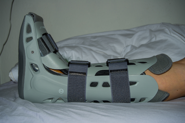 Orthotics & Bracing at Elegance Diabetic Foot & Ulcer Clinic (EDFC), India