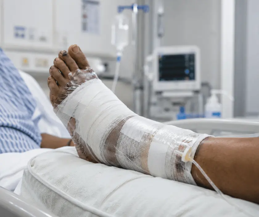 osteomyelitis-surgery