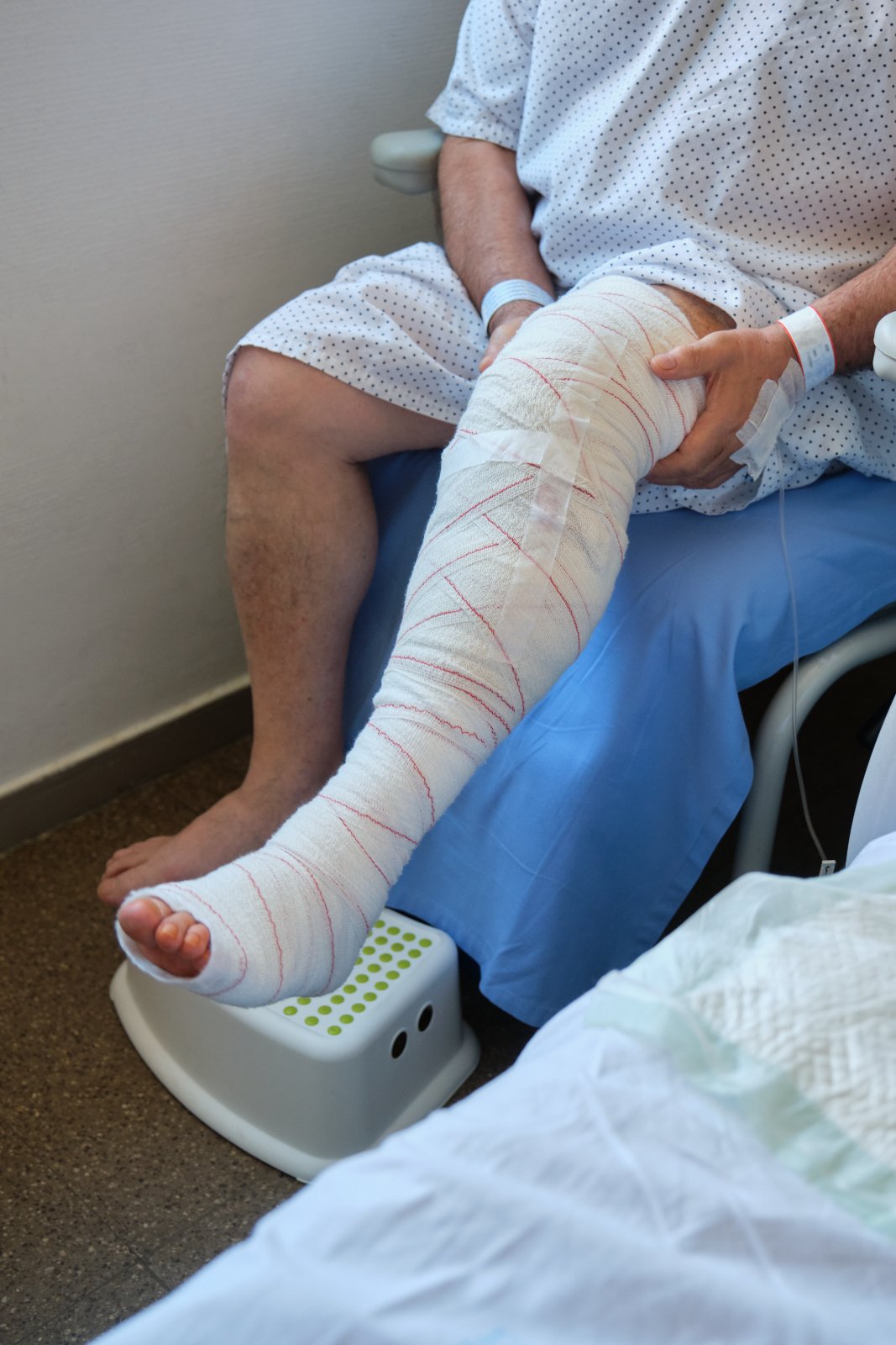 Advanced Non-Healing Ulcer Treatment in Surat | Expert Care