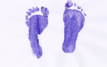 Pedobarogram at Elegance Diabetic Foot & Ulcer Clinic (EDFC), India