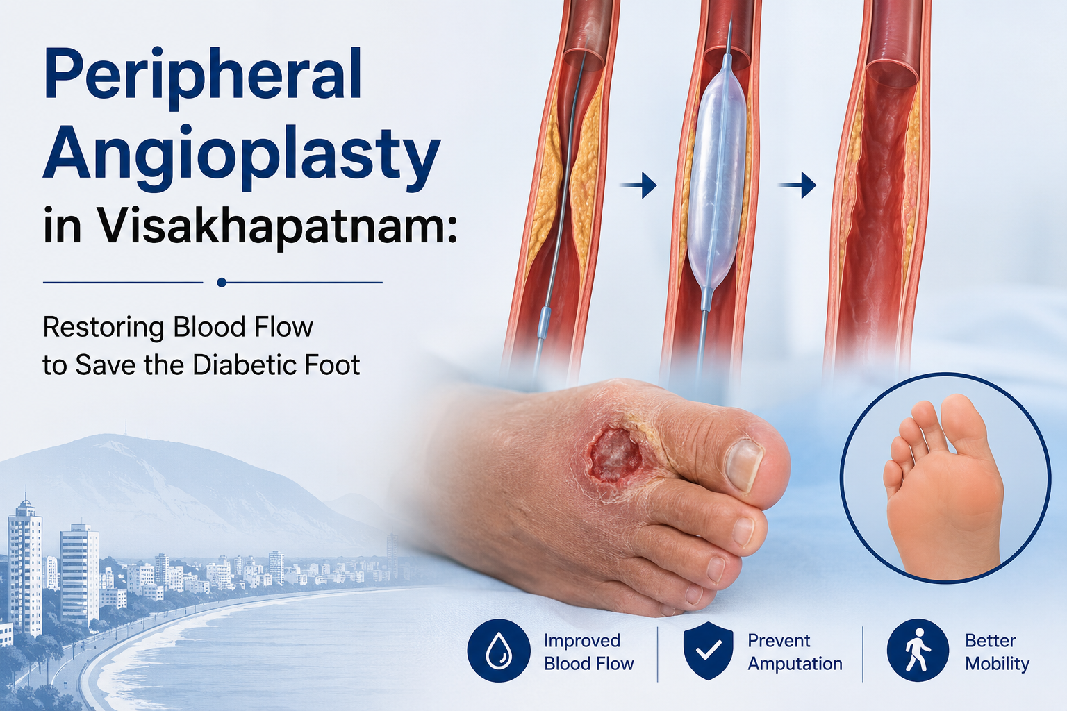 Peripheral Angioplasty in Visakhapatnam: Restoring Blood Flow to Save the Diabetic Foot