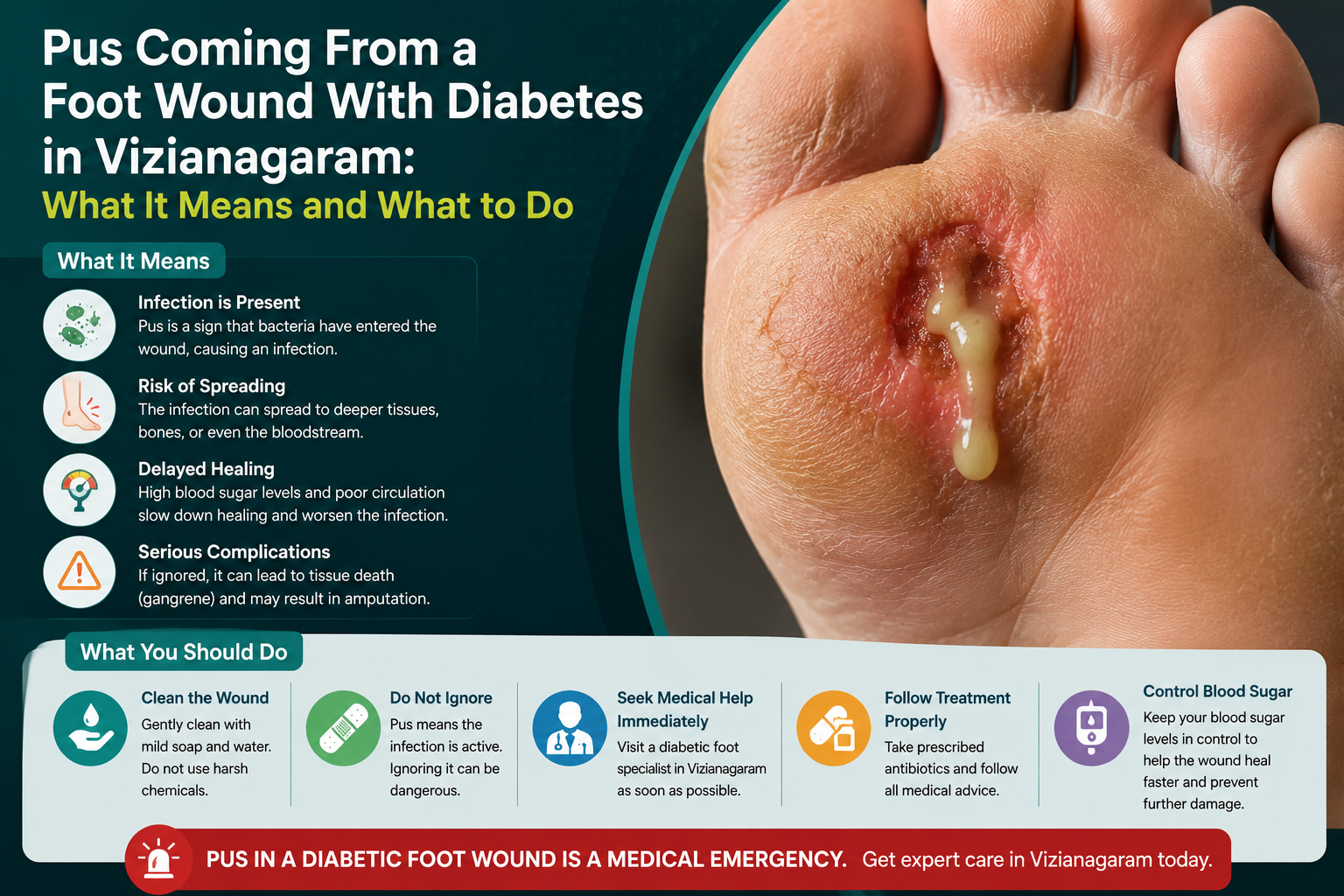 Pus Coming From a Foot Wound With Diabetes in Vizianagaram: What It Means and What to Do