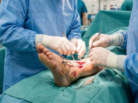 Reconstructive Foot Surgery