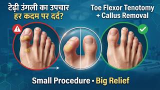 Flexor Tenotomy in Surat: A Simple Procedure to Heal Diabetic Toe Ulcers