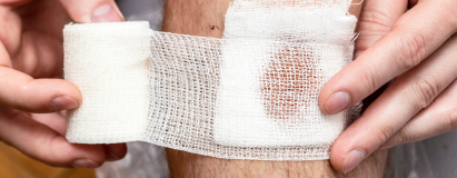 Traumatic & Non-Healing Wounds at Elegance Diabetic Foot & Ulcer Clinic (EDFC), India