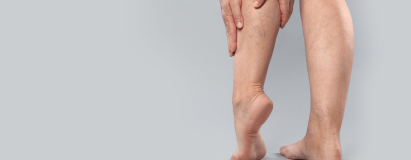 Venous Leg Ulcers at Elegance Diabetic Foot & Ulcer Clinic (EDFC), India