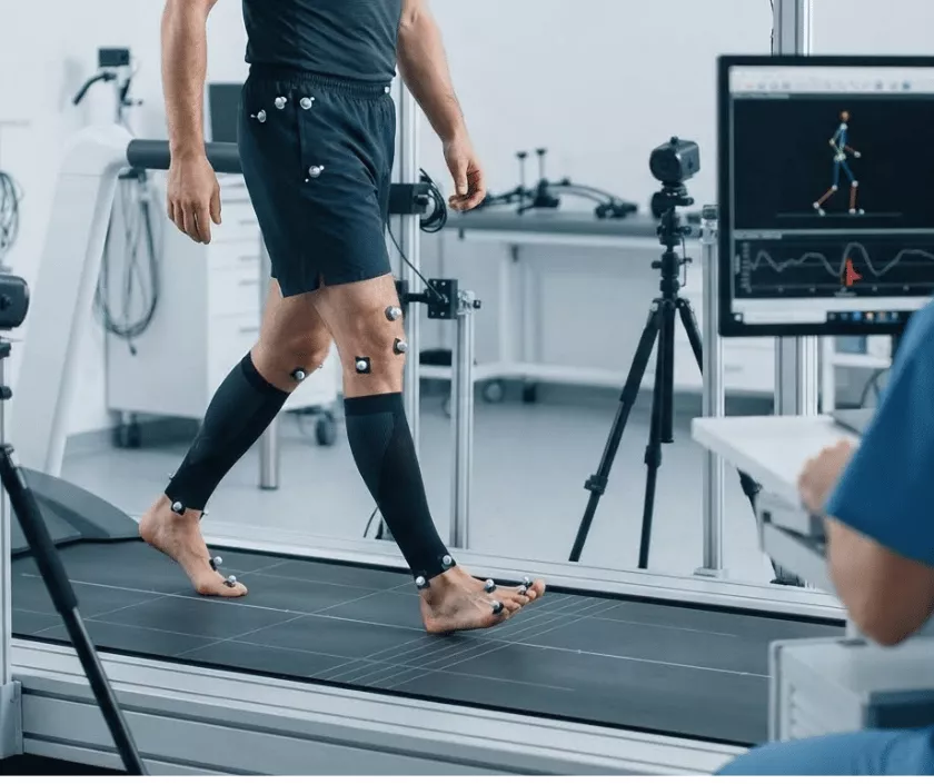 Video Gait Analysis