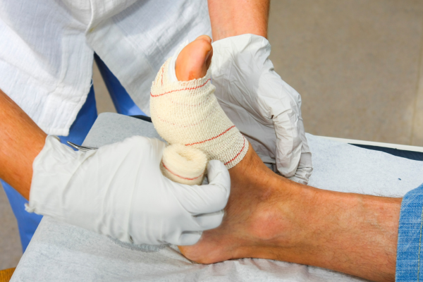 Wound Care & Debridement at Elegance Diabetic Foot & Ulcer Clinic (EDFC), India